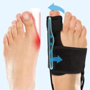 Recovist - Bunion Brace